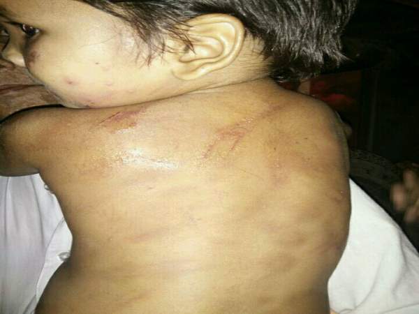 मासूम बताती है अपने साथ बीती दास्तान