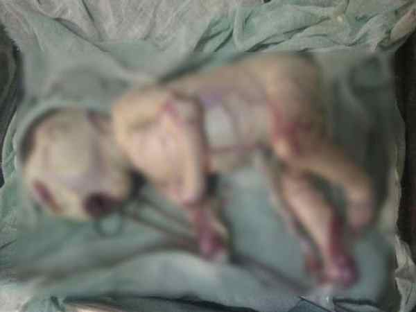 शरीर में जुड़ा हुआ था सिर