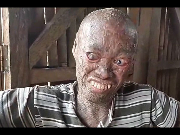  जिंदा भूत कहकर चिढ़ाते हैं लोग