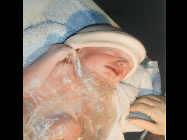  शरीर से बाहर निकली थी आंतें