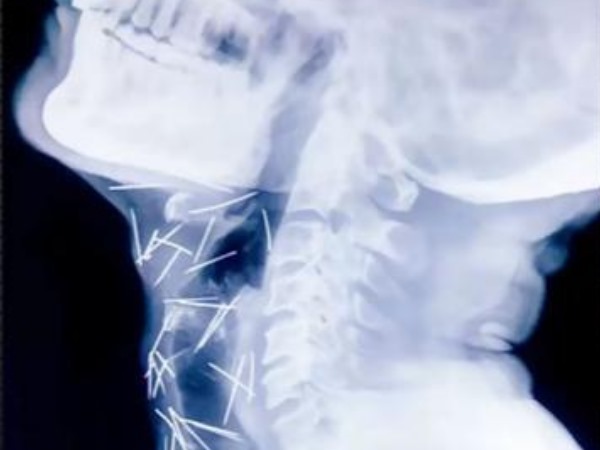 कहां-कहां थीं पिनें?