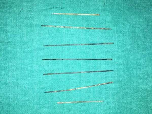 डॉक्टरों ने किया ऑपरेशन