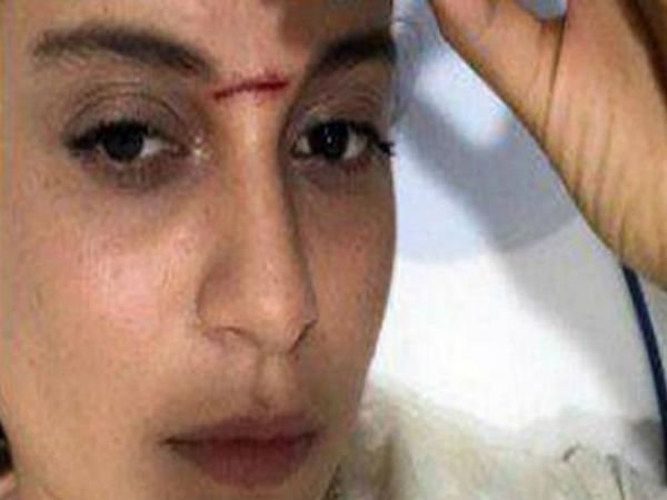 चोट को माना पेेेेशवा टीका 