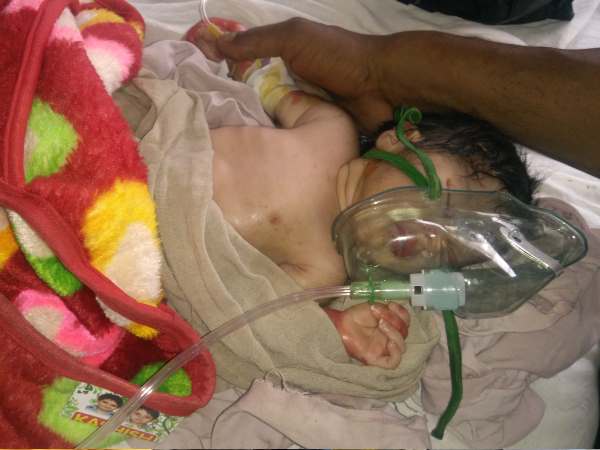 बच्चों के इलाज के लिए डॉक्टर कम