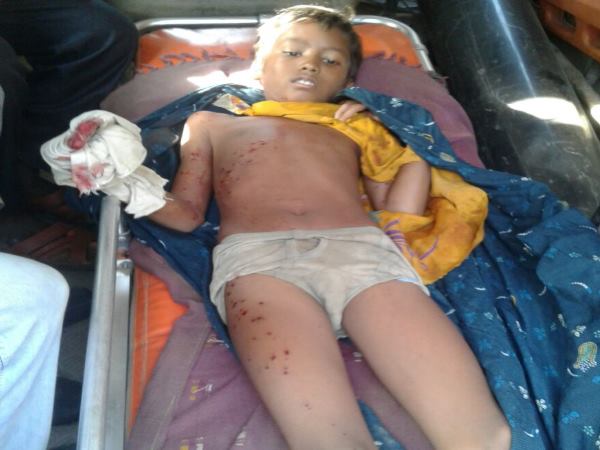 बैटरी को बिजली के तारों से डायरेक्ट चार्ज कर रहा था अरविंद