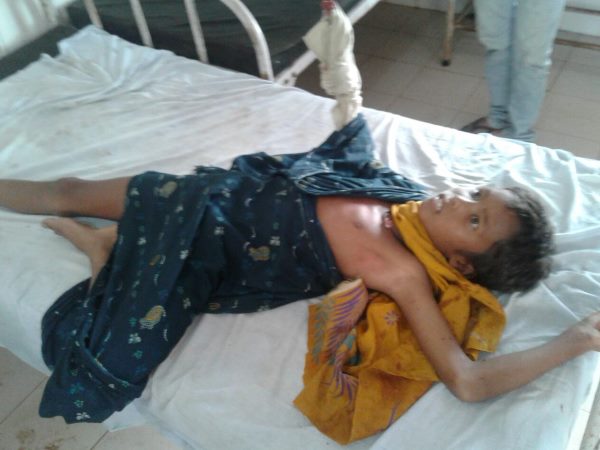 शरीर में अंदर तक घुस गए बैटरी के टुकड़े 