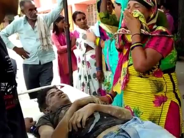 गंभीर रूप से घायल लखनऊ रेफर गंभीर रूप से घायल लखनऊ रेफर