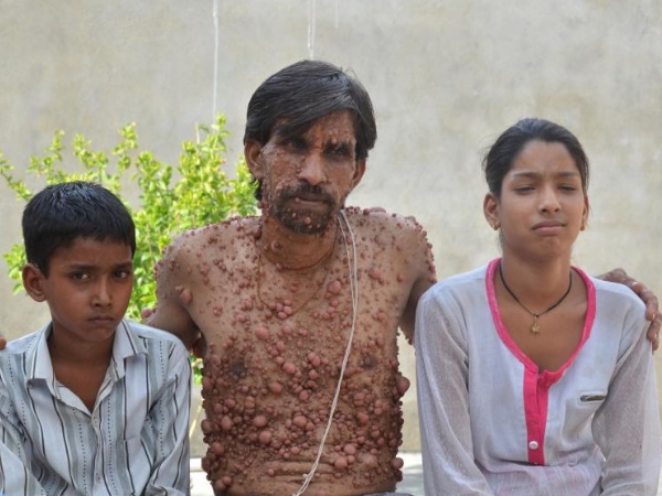 'लोग बनाते हैं मजाक'