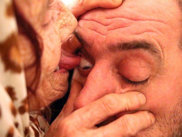 यहां आंखें चाट कर होता है इलाज