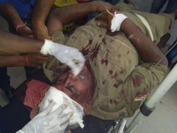 अतिक्रमण हटाने गई पुलिस हुई घायल