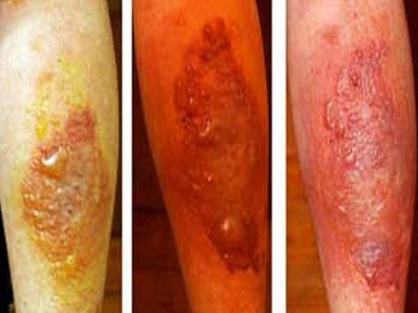 ऐसा हो जाता है शरीर