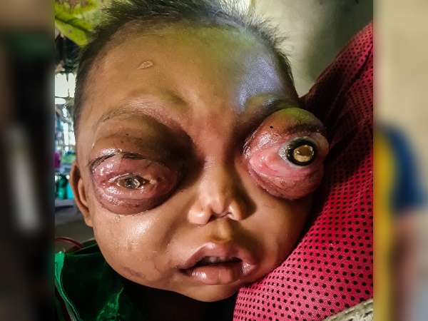 ऐसे शुरू हुई समस्या