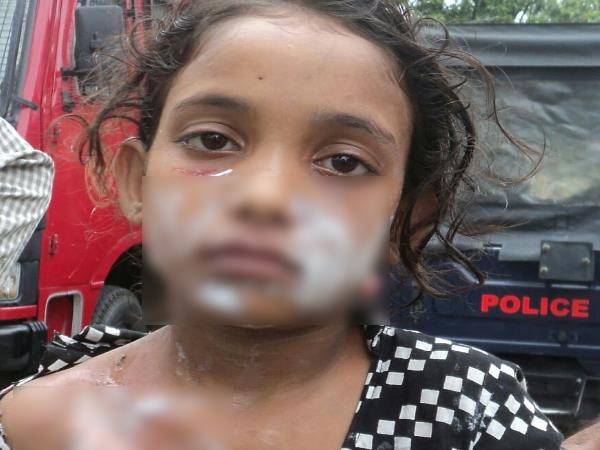 Shopkeeper burn Girl Child for do not take coin as return Shopkeeper burn Girl Child for do not take coin as return