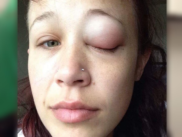 फिर भी नहीं हारी उम्मीद