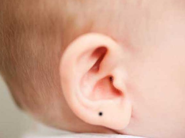 कानों पर तिल