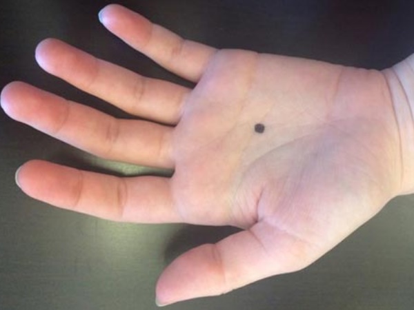 हाथों पर तिल