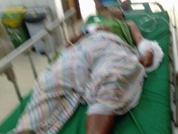 हमले में लहूलुहान हो गया रॉबर्ट