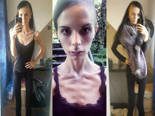 खुद को किसी सूरत में मोटी नहीं देख सकती थीं जूलिया