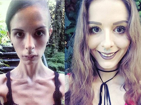 इस खतरनाक बीमारी से जूझ रही थीं