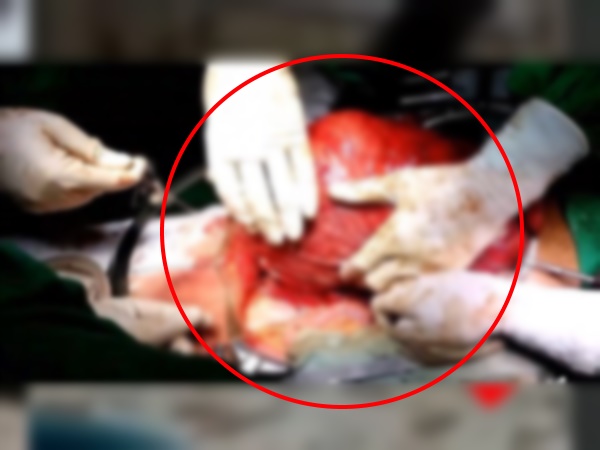 तस्वीर हैरान कर देगी