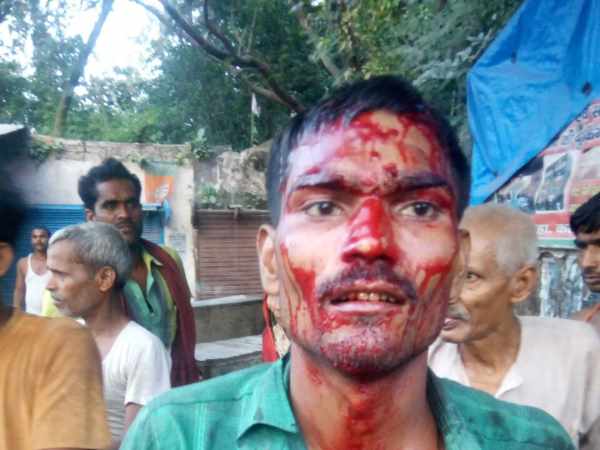 जमीनी विवाद की वजह से हुआ हमला