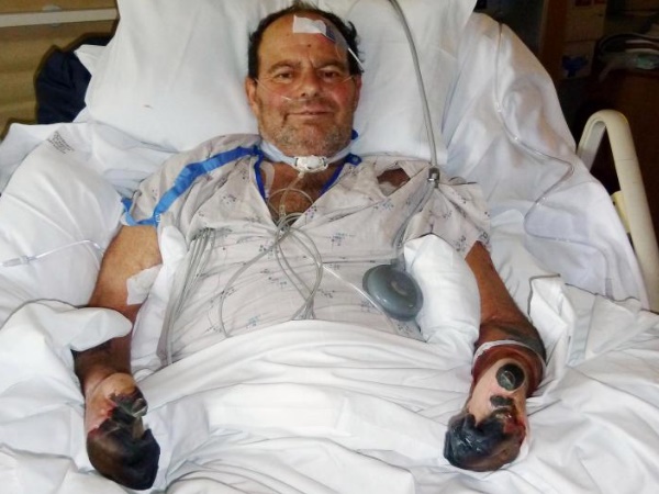 हाथों-पैरों की उंगलियां पड़ गईं काली