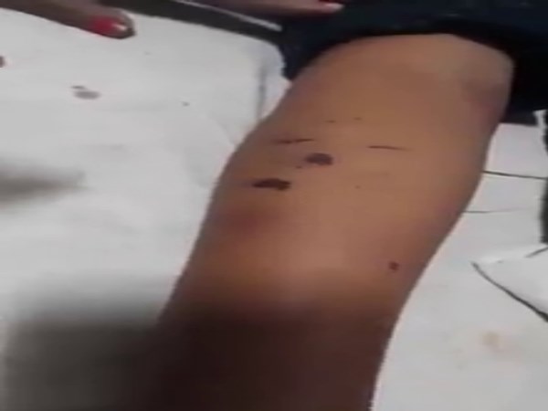 क्या है डॉक्टरों का कहना