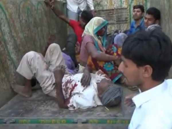 A bus overturned on the road, many injured in Aligarh A bus overturned on the road, many injured in Aligarh