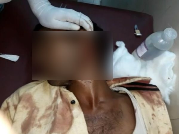 Wife attacks on his husband for having illegal relationship