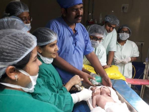 Double head child shock everybody but all is good Double head child shock everybody but all is good