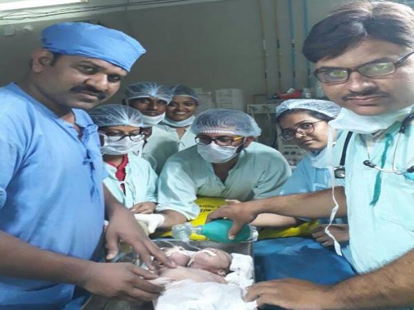 Double head child shock everybody but all is good Double head child shock everybody but all is good