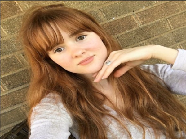 Kali Kushner photo goes Viral for Before-and-After Acne Kali Kushner photo goes Viral for Before-and-After Acne