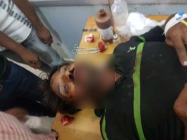 Two community clshed in Sultanpur after children bursted cracker near goat