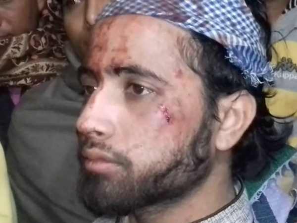 पुलिस ने किया केस दर्ज