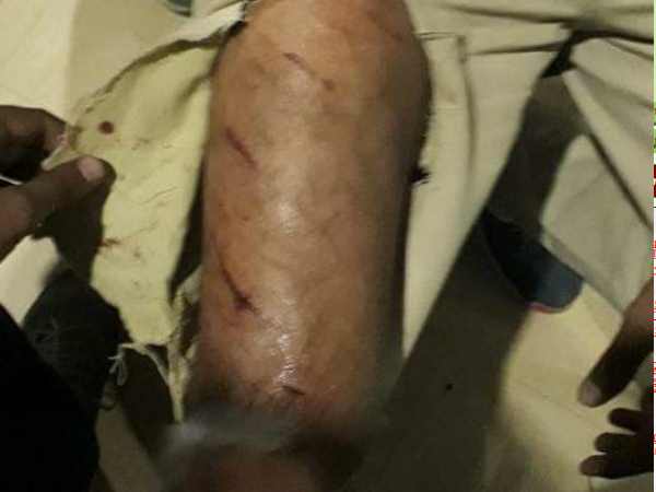 Allahabad mayor candidate Abhilasha Gupta injured in accident Allahabad mayor candidate Abhilasha Gupta injured in accident