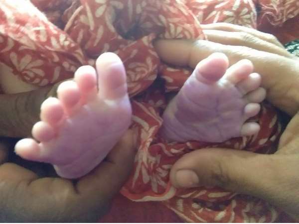  A strange child born in Maharashtra
