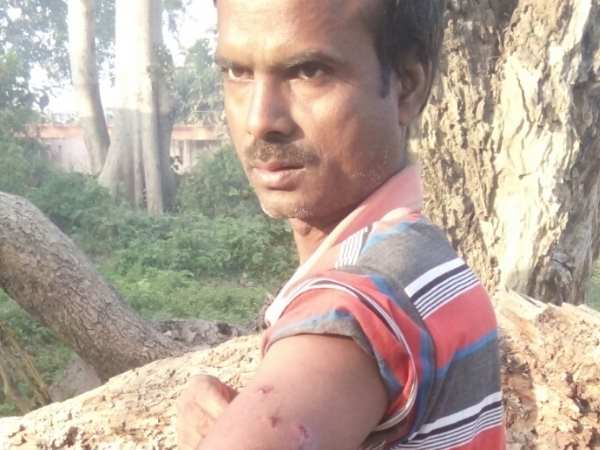 Santosh fight with leopard in Bahraich, Uttar Pradesh