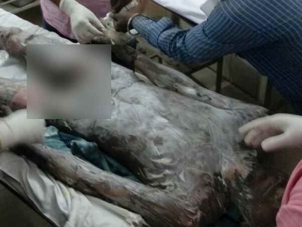 Boiler blast in NTPC in Raebareli, many dead in this incident