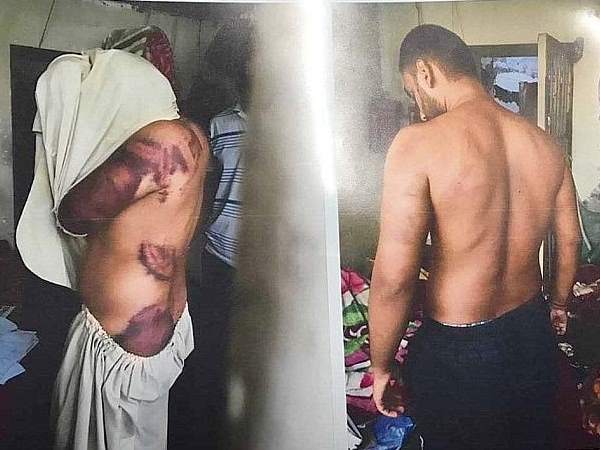 जज को दिखाए थे पिटाई के निशान
