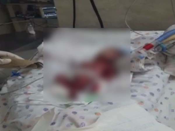 मैक्स अस्पताल पर लगा आरोप