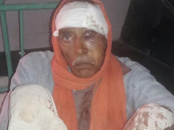 हमले ये सभी हुए घायल