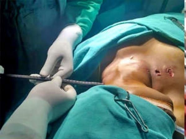  काट-काटकर निकाला गया सरिया