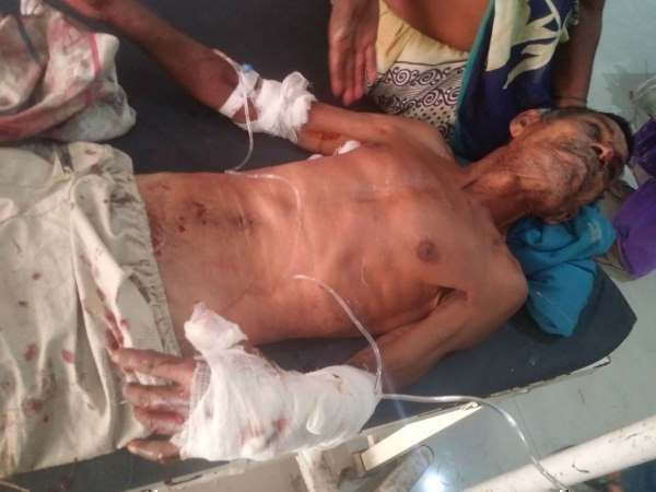 बुजुर्ग पर किया हमला