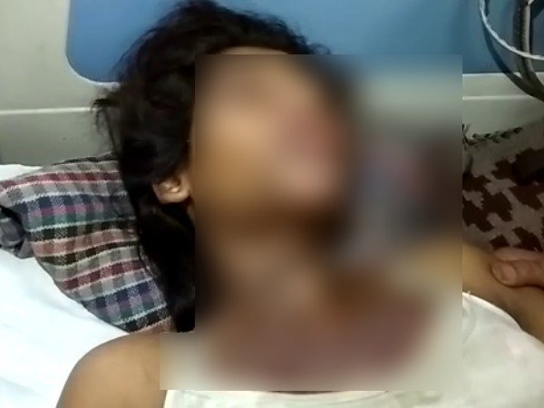 धमकी से नहीं डरी तो जला दिया जिंदा