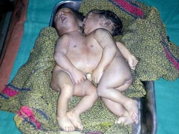 10वीं बार की डिलीवरी में हुआ ऐसा