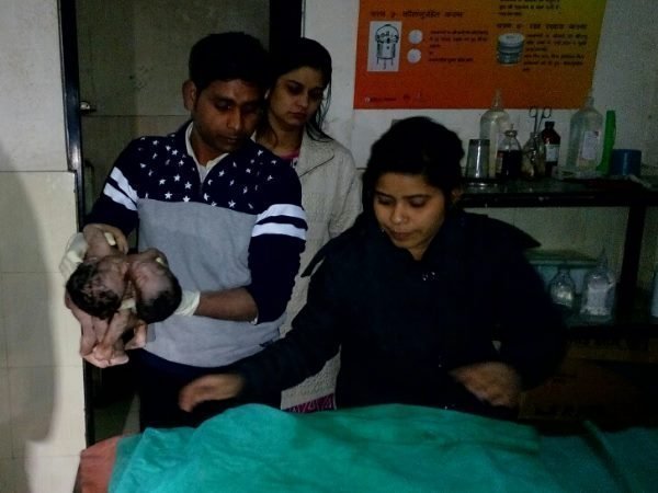 कनजॉइंट टवींस होते हैं विचित्र