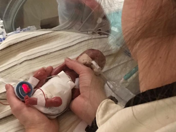 केवल 5 प्रतिशत थी बचने की उम्मीद