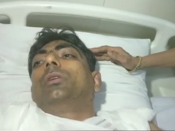 आग तेज थी निकलने का रास्ता तंग, सब एक-दूसरे पर गिरे जा रहे थे