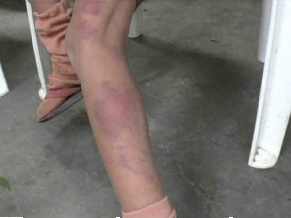 teacher beaten 7 yr old girl in hapur