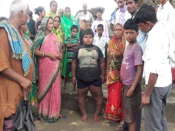 madhepura 8 years old girl weight 85 kilogram bihar 